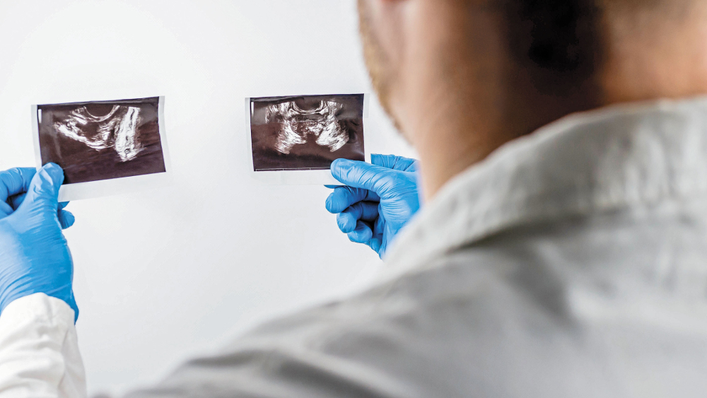 En etapas iniciales el cáncer de próstata no presenta síntomas, por lo que se recomienda que los hombres mayores de 40 años acudan a revisión con el urólogo. Foto: Shutterstock