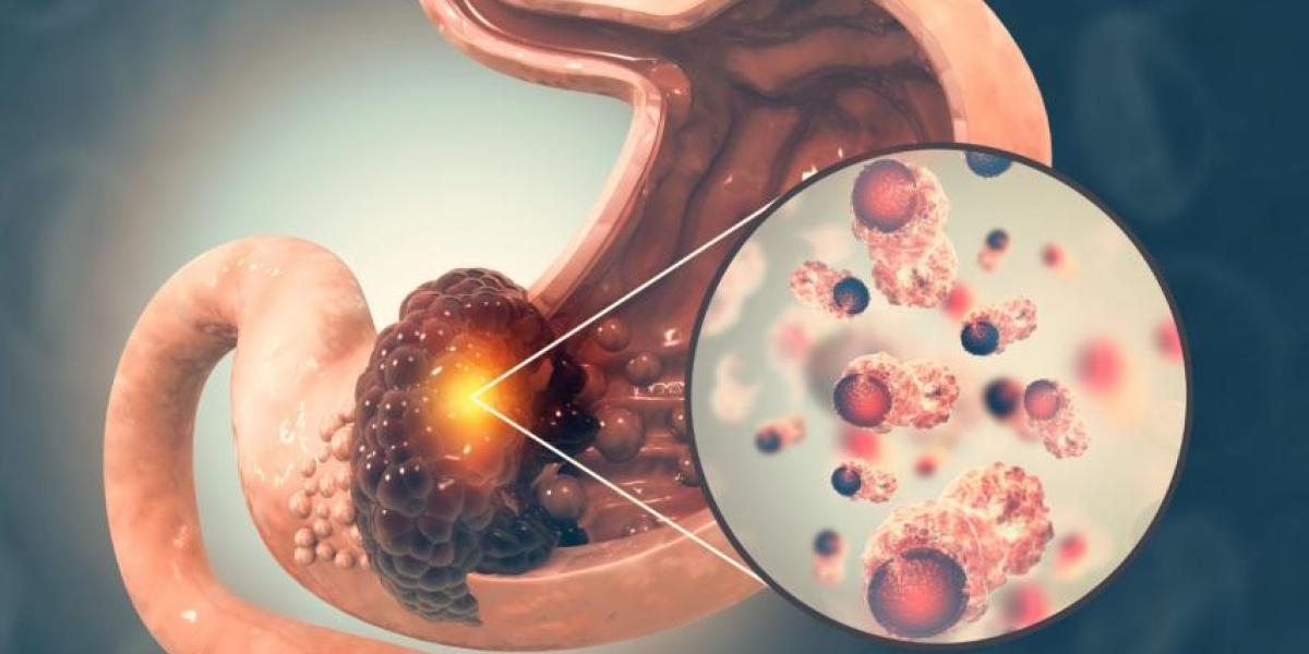 Termina maratón Guadalupe-Reyes, conoce como mejorar tu salud intestinal