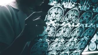 La prueba, desarrollada por la multinacional japonesa Fujirebio Diagnostics, mide la proporción de dos proteínas en la sangre.
Para más información del tema, visita: https://www.eleconomista.com.mx/arteseideas/eu-aprueba-inedito-primer-analisis-sangre-detectar-alzheimer-20250516-759442.html
¡Síguenos en nuestras redes sociales para mantenerte informado!
Twitter: https://twitter.com/eleconomista
Facebook: https://www.facebook.com/ElEconomista.mx
Instagram: https://www.instagram.com/eleconomistamx
LinkedIn: https://www.linkedin.com/company/el-economista/
#ElEconomista #EETV