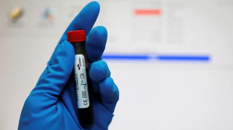 Technician holds test tube with blood sample at Russian anti-doping laboratory in Moscow - A technician holds a test tube with a blood sample at the Russian anti-doping laboratory in Moscow, Russia, May 24, 2016. To match story SPORT-DOPING/RUSSIA-PUTIN  REUTERS/Sergei Karpukhin/File Photo