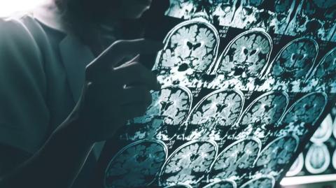 Las neuronas son células que necesitan combustible para su funcionamiento, y el combustible esencial es, precisamente, la glucosa. Foto: Shutterstock.