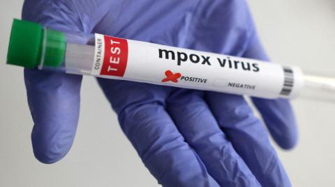 En su último reporte sobre el brote multicontinental del virus mpox o viruela símica este 31 de julio, la Organización Mundial de la Salud (OMS) omitió información crítica sobre la situación en México, a pesar de que los datos públicos del país revelan una tendencia preocupante.

Para más información del tema, visita: https://www.eleconomista.com.mx/politica/oms-omite-mexico-reporte-sobre-viruela-mono-pese-tendencia-creciente-20250801-770824.html 

¡Síguenos en nuestras redes sociales para mantenerte informado!

Twitter: https://twitter.com/eleconomista 
Facebook: https://www.facebook.com/ElEconomista.mx
Instagram: https://www.instagram.com/eleconomistamx
LinkedIn: https://www.linkedin.com/company/el-economista/

#ElEconomista #EETV