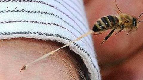 Picadura de abeja.
