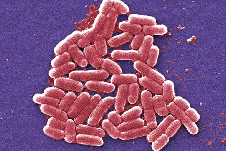 Micrografía electrónica de baja temperatura de un cúmulo de bacterias E. coli ampliado cien mil veces.