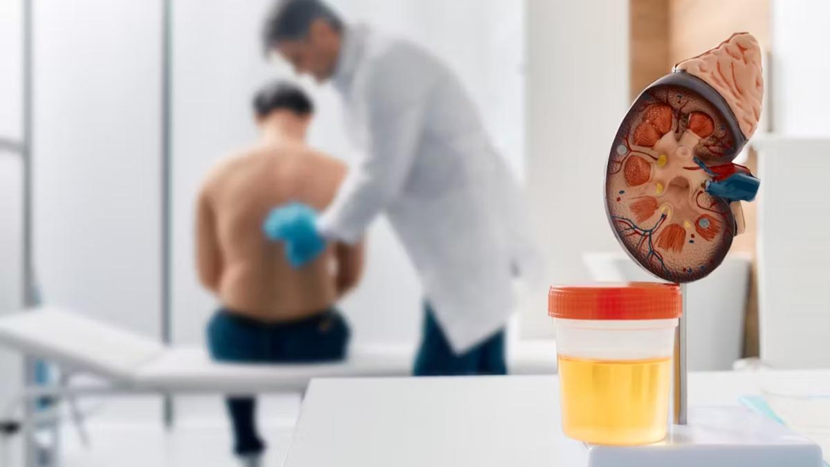 Enfermedad renal crónica genera gasto de 10,000 millones de pesos al año al sistema de salud en México