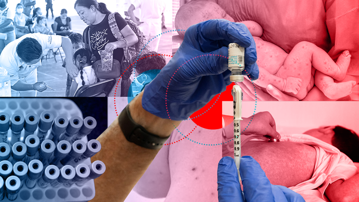 México cerró 2025 con el mayor brote de sarampión y el primer lugar de muertes de tos ferina en América