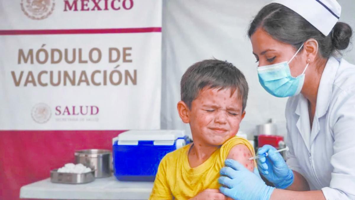 Salud CDMX confirma dos muertes y 576 casos de sarampión