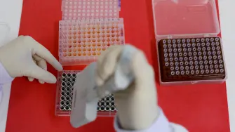 Las autoridades sanitarias mexicanas notificaron a la Organización Mundial de la Salud (OMS) sobre el caso detectado, conforme al protocolo establecido para ello en el Reglamento Sanitario Internacional.

Para más información del tema, visita: https://www.eleconomista.com.mx/politica/secretaria-salud-confirma-primer-caso-humano-influenza-aviar-h5n1-mexico-20250404-753552.html

¡Síguenos en nuestras redes sociales para mantenerte informado!

Twitter: https://twitter.com/eleconomista 
Facebook: https://www.facebook.com/ElEconomista.mx
Instagram: https://www.instagram.com/eleconomistamx
LinkedIn: https://www.linkedin.com/company/el-economista/

#ElEconomista #EETV