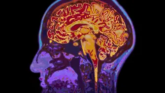 Resonancia magnética del cerebro. SpeedKingz/Shutterstock
