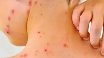 La Ciudad de México reportó su primer deceso por sarampión durante el brote activo en México, que suma casi 9,000 casos confirmados y 28 muertes a nivel nacional.

Para más información del tema, visita: https://www.eleconomista.com.mx/politica/salud-confirma-primera-muerte-sarampion-cdmx-brote-deja-28-fallecidos-pais-20260210-799239.html

¡Síguenos en nuestras redes sociales para mantenerte informado!

Twitter: https://twitter.com/eleconomista 
Facebook: https://www.facebook.com/ElEconomista.mx
Instagram: https://www.instagram.com/eleconomistamx
LinkedIn: https://www.linkedin.com/company/el-economista/

#ElEconomista #EETV