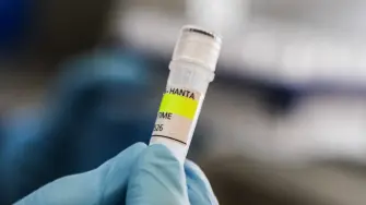 El hantavirus suele transmitirse a partir de roedores infectados a través de la orina, las heces y la saliva. Solo existe transmisión documentada de persona a persona para una cepa, el virus Andes, detectado en ambos casos confirmados del crucero que siguen con vida.