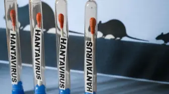 La cepa de hantavirus del crucero que salió de Argentina es transmisible entre humanos, afirma la OMS.
El navío neerlandés continúa en las costas de Cabo Verde después de que tres personas murieran a bordo por un brote de hantavirus. La OMS ha confirmado que se trata de una rara cepa del virus que se puede transmitir entre humanos, y no solo a través del contacto con animales, como es lo usual para esta enfermedad.

¡Síguenos en nuestras redes sociales para mantenerte informado!

Twitter: https://twitter.com/eleconomista 
Facebook: https://www.facebook.com/ElEconomista.mx
Instagram: https://www.instagram.com/eleconomistamx
LinkedIn: https://www.linkedin.com/company/el-economista/

#ElEconomista #Hantavirus