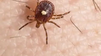 Estos parásitos pueden desencadenar una reacción del sistema inmunitario que hace que el cuerpo empiece a “rechazar” la carne roja. Lo más sorprendente es que esta reacción no ocurre inmediatamente. Puede aparecer horas después de haber comido, lo que hace que muchas personas no la relacionen con los alimentos ingeridos