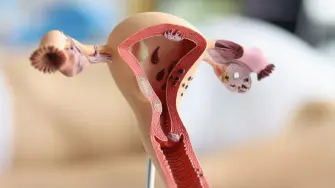 La endometriosis genera un entorno en el que interactúan hormonas, células inmunitarias, mediadores inflamatorios y fibras nerviosas.