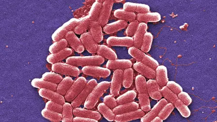 Micrografía electrónica de baja temperatura de un cúmulo de bacterias E. coli ampliado cien mil veces.