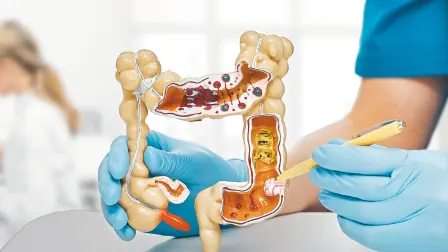 De acuerdo con la OMS, a nivel mundial cerca del 48% de los pacientes fallecen por no tener una atención oportuna. Foto: Shutterstock.