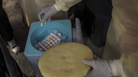 La mpox se caracteriza por lesiones cutáneas, como pústulas, fiebre alta y dolores musculares. Identificada por primera vez en República Democrática del Congo en 1970.