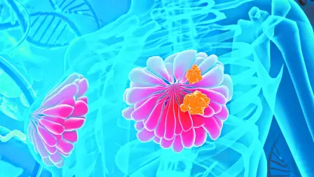 Mujeres unidas, tomadas de la mano, simbolizan la fuerza colectiva en la lucha contra el cáncer de mama y la importancia de la detección oportuna