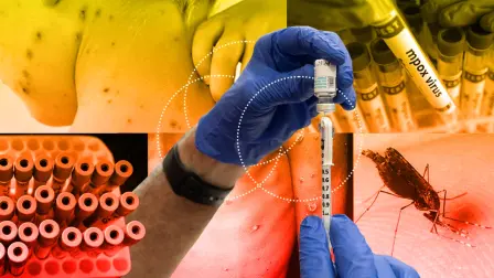 La Agencia de Seguridad Sanitaria de Reino Unido (UKHSA) indicó este lunes que había identificado una nueva variante del mpox en Inglaterra en una persona que había viajado recientemente a Asia.

Para más información del tema, visita: https://www.eleconomista.com.mx/internacionales/descubren-nueva-variante-viruela-mono-inglaterra-grave-20251208-790158.html

¡Síguenos en nuestras redes sociales para mantenerte informado!

Twitter: https://twitter.com/eleconomista
Facebook: https://www.facebook.com/ElEconomista.mx
Instagram: https://www.instagram.com/eleconomistamx
LinkedIn: https://www.linkedin.com/company/el-economista/

#ElEconomista #EETV