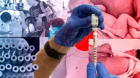 En el contexto del incremento de contagios en México, las personas que viven con diabetes —especialmente aquellas con niveles de glucosa fuera de control— representan uno de los grupos de mayor vulnerabilidad biológica. No se trata solo del riesgo de contraer el virus, sino de la alta probabilidad de desarrollar cuadros clínicos críticos. 

Para más información del tema, visita: https://www.eleconomista.com.mx/arteseideas/casos-sarampion-mexico-superan-15-000-alertan-riesgo-pacientes-diabetes-20260417-809196.html 

¡Síguenos en nuestras redes sociales para mantenerte informado! 

Twitter: https://twitter.com/eleconomista 
Facebook: https://www.facebook.com/ElEconomista.mx 
Instagram: https://www.instagram.com/eleconomistamx 
LinkedIn: https://www.linkedin.com/company/el-economista/ 

#ElEconomista #Sarampión