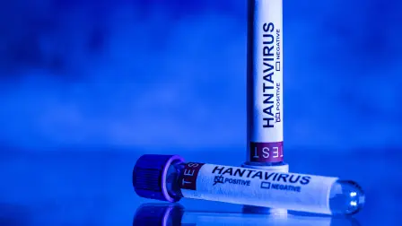 This illustration picture taken in studio in Paris on May 11, 2026  shows a vial with a sticker mentioning  "hantivirus". A deadly hantavirus outbreak on a cruise ship has spurred global concern over the potential spread of the virus among and from ship evacuees as they head back to their home countries. Here are the World Health Organization's main recommendations to limit the transmission risks and to better protect those exposed to the rare virus, which usually spreads among rodents, and for which there is no vaccine or treatment. (Photo by JOEL SAGET / AFP)