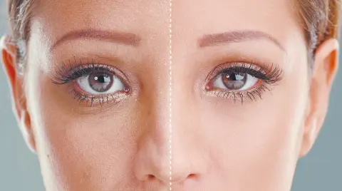 Los tratamientos no invasivos ganan espacio por su recuperación más rápida y resultados que conservan expresión e identidad.