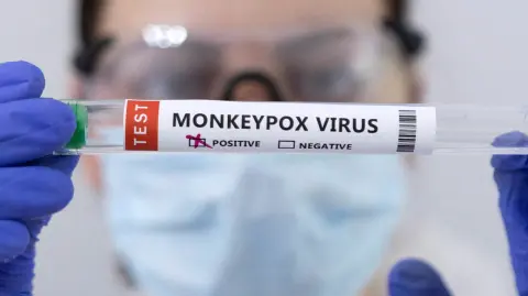 El Ministerio fue informado "de un primer caso humano de Mpox de clado 1b en el territorio nacional, en Bretaña", en el noroeste de Francia, detalló el comunicado.

Para más información del tema, visita: https://www.eleconomista.com.mx/internacionales/identifican-primer-caso-nueva-variante-mpox-francia-20250106-740746.html

¡Síguenos en nuestras redes sociales para mantenerte informado!

Twitter: https://twitter.com/eleconomista 
Facebook: https://www.facebook.com/ElEconomista.mx
Instagram: https://www.instagram.com/eleconomistamx
LinkedIn: https://www.linkedin.com/company/el-economista/

#ElEconomista #EETV