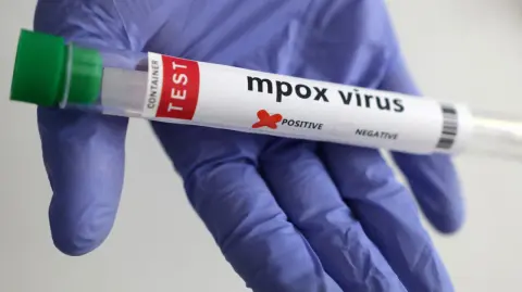 En su último reporte sobre el brote multicontinental del virus mpox o viruela símica este 31 de julio, la Organización Mundial de la Salud (OMS) omitió información crítica sobre la situación en México, a pesar de que los datos públicos del país revelan una tendencia preocupante.

Para más información del tema, visita: https://www.eleconomista.com.mx/politica/oms-omite-mexico-reporte-sobre-viruela-mono-pese-tendencia-creciente-20250801-770824.html 

¡Síguenos en nuestras redes sociales para mantenerte informado!

Twitter: https://twitter.com/eleconomista 
Facebook: https://www.facebook.com/ElEconomista.mx
Instagram: https://www.instagram.com/eleconomistamx
LinkedIn: https://www.linkedin.com/company/el-economista/

#ElEconomista #EETV