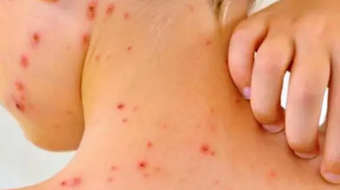 Para ser considerado libre de sarampión, un país en el que se produce un brote debe volver a tener cero casos en un plazo de 12 meses.

Para más información del tema, visita: https://www.eleconomista.com.mx/internacionales/america-perder-estatus-zona-libre-sarampion-brotes-canada-mexico-eu-20251006-780185.html 

¡Síguenos en nuestras redes sociales para mantenerte informado!

Twitter: https://twitter.com/eleconomista 
Facebook: https://www.facebook.com/ElEconomista.mx
Instagram: https://www.instagram.com/eleconomistamx
LinkedIn: https://www.linkedin.com/company/el-economista/

#ElEconomista #EETV