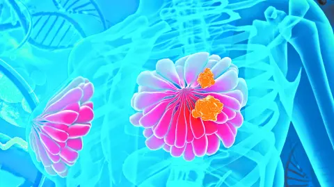 Mujeres unidas, tomadas de la mano, simbolizan la fuerza colectiva en la lucha contra el cáncer de mama y la importancia de la detección oportuna