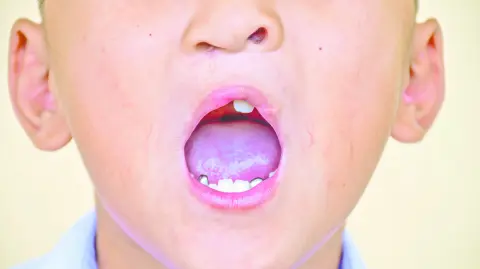 El correcto abordaje y tratamiento de dicho padecimiento requiere de un enfoque multidisciplinario.