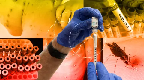 La Agencia de Seguridad Sanitaria de Reino Unido (UKHSA) indicó este lunes que había identificado una nueva variante del mpox en Inglaterra en una persona que había viajado recientemente a Asia.

Para más información del tema, visita: https://www.eleconomista.com.mx/internacionales/descubren-nueva-variante-viruela-mono-inglaterra-grave-20251208-790158.html

¡Síguenos en nuestras redes sociales para mantenerte informado!

Twitter: https://twitter.com/eleconomista
Facebook: https://www.facebook.com/ElEconomista.mx
Instagram: https://www.instagram.com/eleconomistamx
LinkedIn: https://www.linkedin.com/company/el-economista/

#ElEconomista #EETV