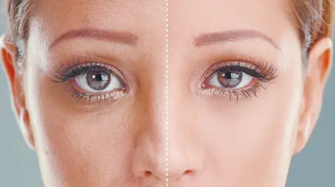 Los tratamientos no invasivos ganan espacio por su recuperación más rápida y resultados que conservan expresión e identidad.