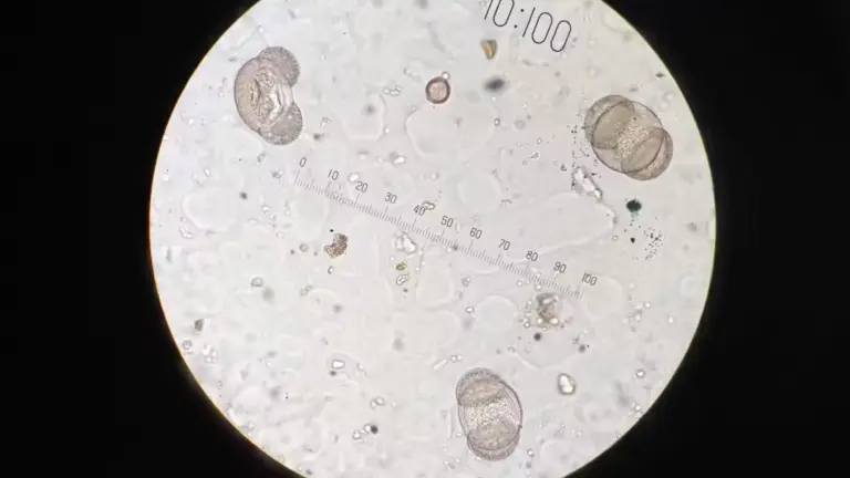 Imagen al microscopio óptico de polen y otras partículas. Los autores, CC BY-SA
